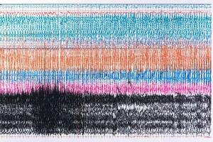 Photograph of brain waves during seizure. photo