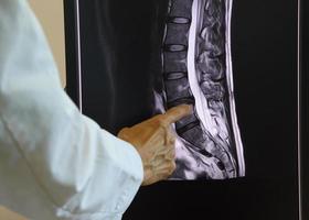 Doctor pointing at lumbar spine MRI photo