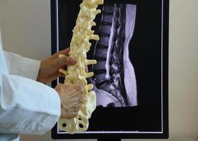 Doctor holding lumbar spine model and MRI on background photo