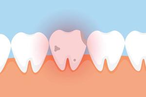 Bad tooth hurting with red danger glow effect vector. A dead tooth vector with a red glow effect. A dead tooth with cavities dental infographic elements concept vector. A tooth with cavities hurting.
