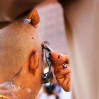 ordination remove hair. photo