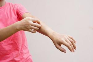 Woman scratching arm from itching on light gray background. Cause of itchy skin include insect bitesConcept of health care skin. photo