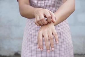 Woman scratching arm from itching on gray background photo