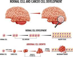 Diagram showing normal cell and cancer cell vector