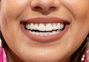 boca de mujer riendo con grandes dientes. hermosa sonrisa femenina sana. salud dental, blanqueamiento, prótesis y cuidado. foto