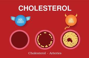 colesterol en la arteria, riesgo para la salud vector