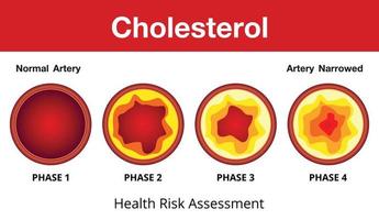 Cholesterol in artery, health risk , vector design