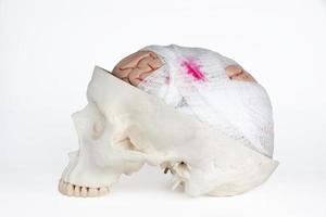 Brain injury model oblique view on the white background photo