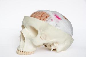 Brain injury model oblique view on the white background photo