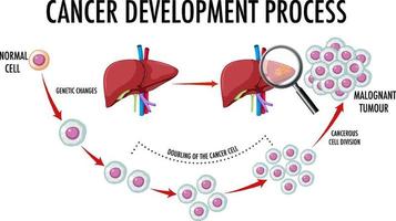 diagrama que muestra el proceso de desarrollo del cáncer vector