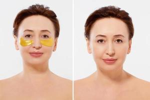 Macro female face before after beauty treatment. Middle aged woman. Beauty portrait of middle age woman with wrinkles and a gold patch under eye isolated. Collagen mask, spa concept. Summer skin care photo