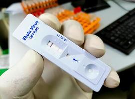 rapid test cassette for ebola virus photo