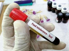 Blood sample for Food Intolerance test photo