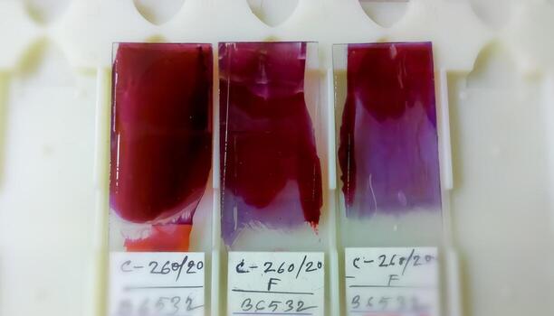 Close view of Histopathology slides stained with leishman stain, displayed and ready for microscopy with selective focus on slides. Cytopathology, Histology. photo