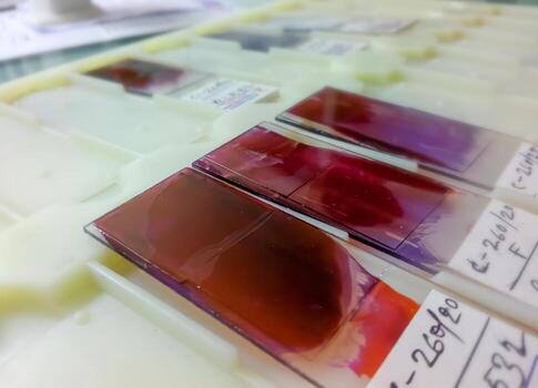 Close view of Histopathology slides stained with leishman stain, displayed and ready for microscopy with selective focus on slides. Cytopathology, Histology. photo