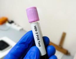 Blood sample for Her-2 or human epidermal growth factor receptor 2 PCR testing for breast cancer diagnosis. photo