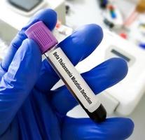 Blood sample for Beta Thalassemia mutation testing in PCR laboratory. photo