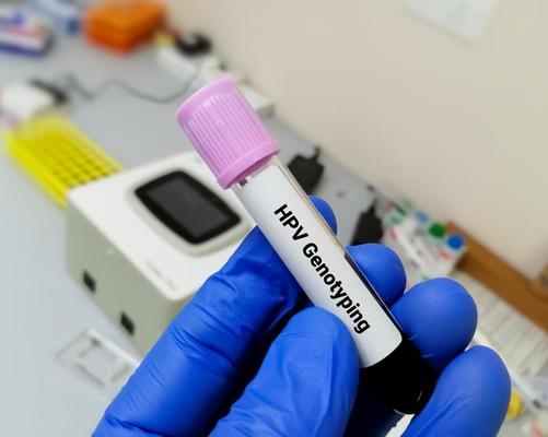 Hpv Or Molluscum This Test Will Tell You - uoiyov8