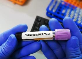 Chlamydia PCR test or  polymerase chain reaction for Chlamydia to detect STD photo