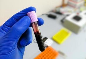 Technician hold lavender tube with blood sample for hematological or whole blood test. photo