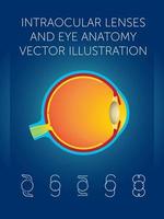 intraocular lenses and eye anatomy vector illustration