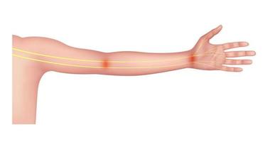 nervio del brazo sobre anatomía humana amarillo. sobre un fondo blanco. conceptos médicos y científicos. 3d vectoriales eps10. vector