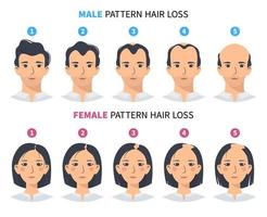 Etapas de pérdida de cabello, patrón de alopecia androgenética masculina y femenina. pasos de infografía vectorial de calvicie en un estilo plano con un hombre y una mujer. mphl y ffl vector