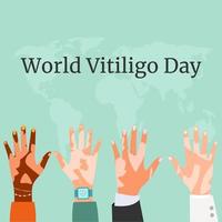 Skin hands with vitiligo depigmantation. Vitiligo awareness.Vector illustration vector