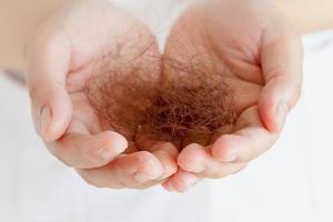 Hair loss close up photo