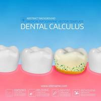 Dental calculus with bacteria. Colorful vector illustration.