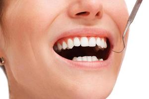 boca femenina con dientes blancos