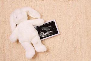 foto ultrasónica de bebé con un juguete
