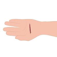 mano lesionada con herida sangrante con herida en la ilustración del vector de la palma de la mano