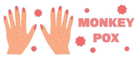 Banner with smallpox monkey. Monkeypox. Hands with a rash. Smallpox symptom. Vector illustration.