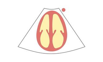 Diagram of Apical 4-Chamber View of Echocardiography. Healthcare Concept vector