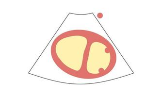 diagrama de la forma d del ventrículo derecho de la vista del eje corto paraesternal en el músculo papilar de la ecocardiografía. concepto de salud vector