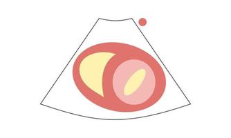 Diagram of Parasternal Short Axis View at Mitral Valve of Echocardiography. Healthcare Concept vector