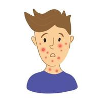 Male suffering from new virus Monkeypox. kid face sick with chickenpox pox virus infection. flat character portrait. Red rash on face - symptoms of smallpox chickempox, monkeypox vector