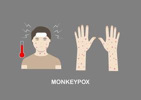 Illustration of monkeypox symptoms vector