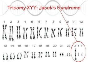 Trisomy XYY Jacobs Syndrome vector