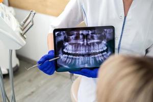 mujer en la consulta del dentista. control y tratamiento dental en una clínica foto