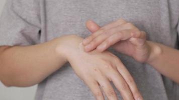 proteção da pele das mãos. close-up vista da mão de mulher aplicando hidratante. problemas de saúde e dermatológicos video