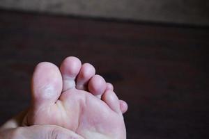 Closed up female feet with french nails on wood floor, Healthy care and medical concept photo