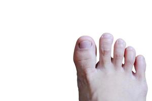pies femeninos cerrados con uñas francesas en el suelo de madera, cuidado saludable y concepto médico foto