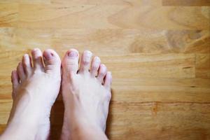 pies femeninos cerrados con uñas francesas en el suelo de madera, cuidado saludable y concepto médico foto
