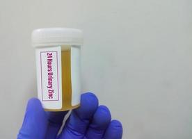 24 hours urinary Zinc testing photo