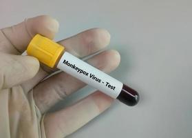Blood sample for Monkeypox virus test. photo