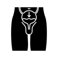 Urinary incontinence glyph icon. Silhouette symbol. Involuntary urination. Enuresis. Urine leakage. Prostate cancer treatment side effects. Men disease. Negative space. Vector isolated illustration