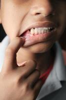 niño con dientes deformados de cerca foto