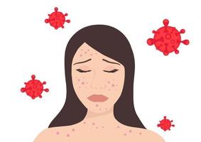 Monkeypox virus concept, woman suffering with rashes on all body. New orthopox virus outbreak pandemic spreading vector illustration